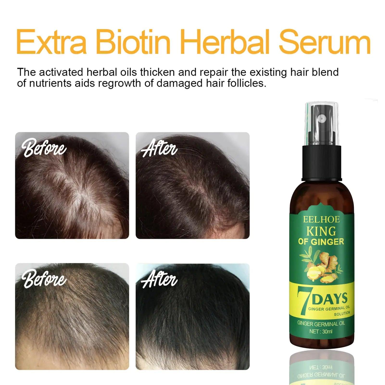 Ginger Hair Growth Serum Spray for Hair Regrowth - Thuraya Care