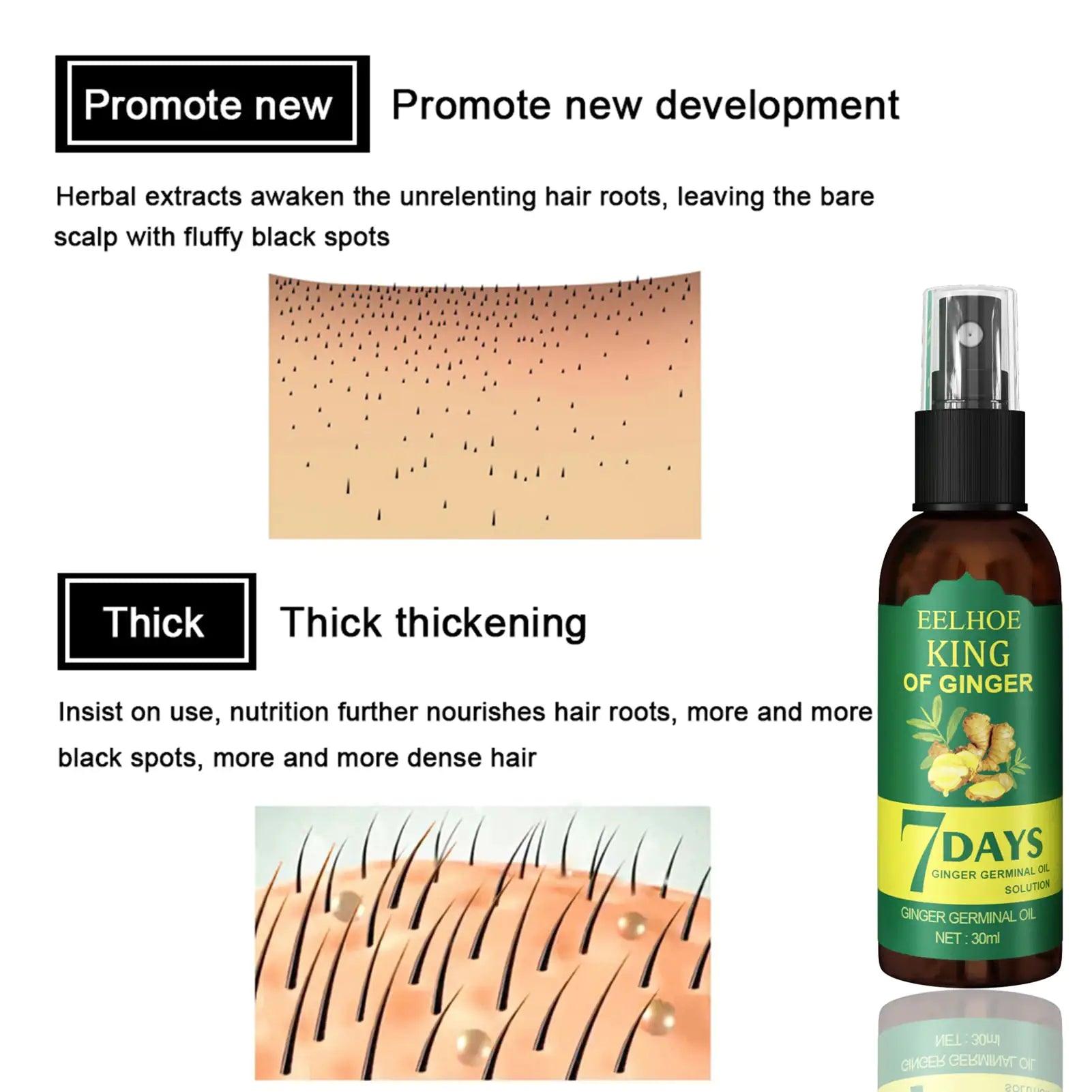 Ginger Hair Growth Serum Spray for Hair Regrowth - Thuraya Care